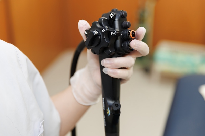 大腸ポリープ切除